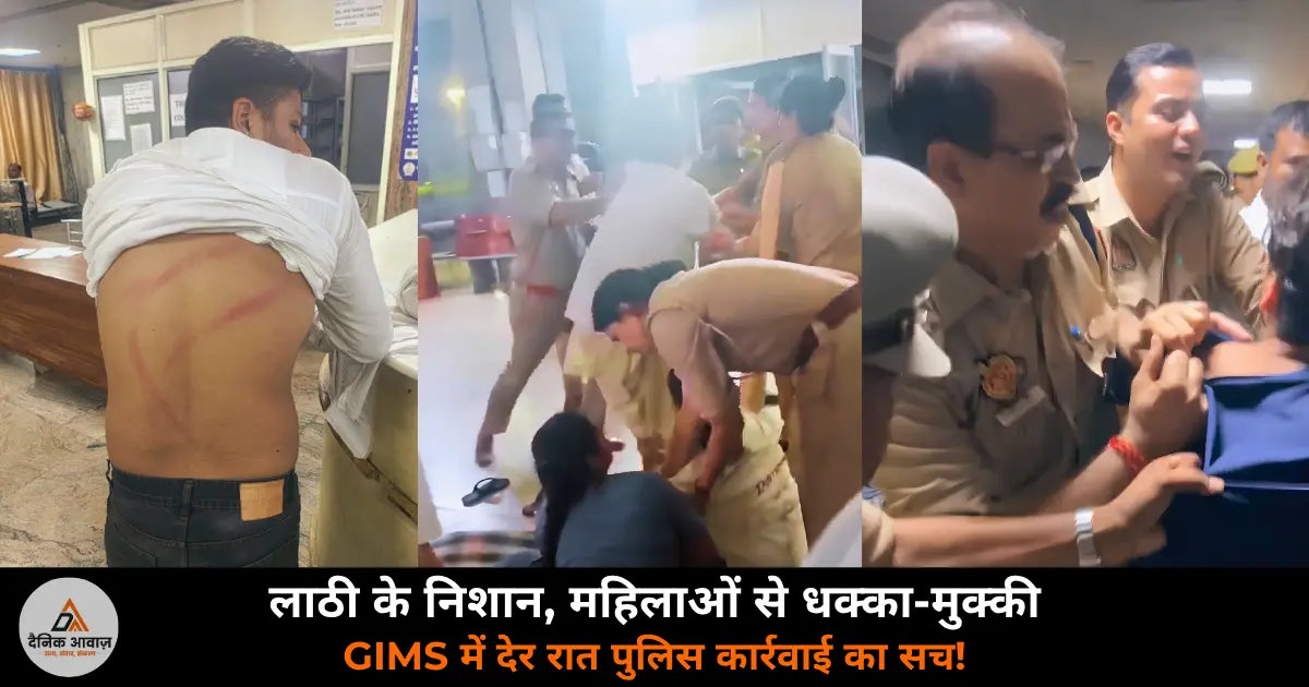 GIMS Greater Noida outsource employees lathi marks police action women workers 2026